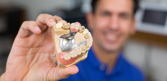 What Is Dental Scrap Refining?